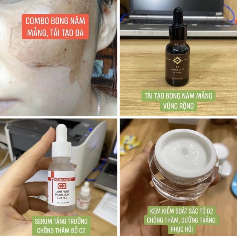 Combo phân giải nám mảng, tái tạo da Handmade