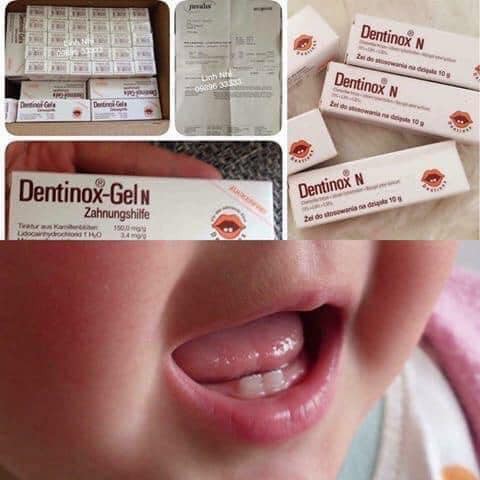 GEL bôi lợi trẻ em : giảm đau, giảm sưng tấy và sốt khi bé mọc răng Dentinox-Gel N