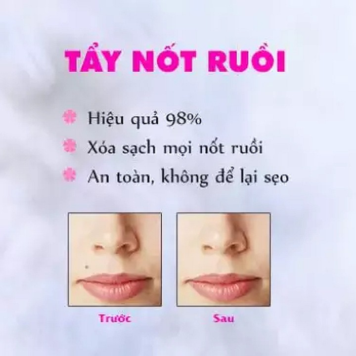 Gel &quot;Thần&quot; Dvelinil của Nga Tẩy Nốt Ruồi, Mụn Cóc, Mụn Thịt, Sẹo Lồi