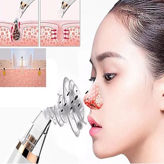 Máy hút mụn đầu đen Black Head Detector dùng pin