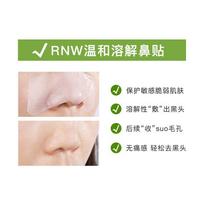 Hàn Quốc RNW miếng dán mũi để mụn đầu đen co lại lỗ chân lông nhẹ nhàng làm sạch chăm sóc chính hãng