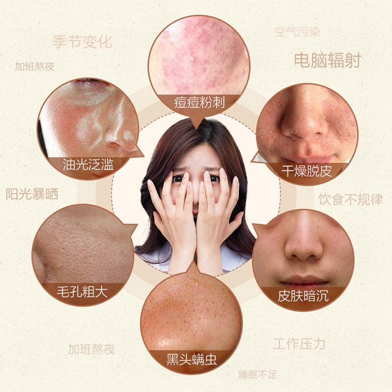 MOLAMGO  [Hàng mới về] Xà phòng tự làm loại bỏ mụn đầu đen vệ sinh sạch làn da