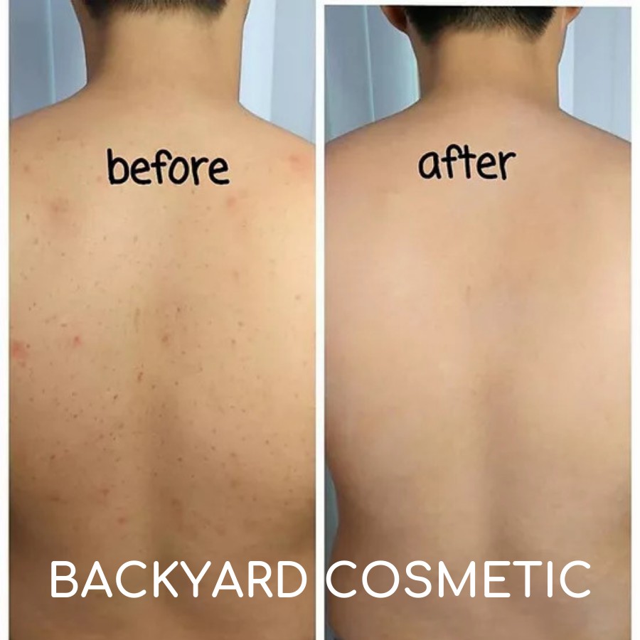 Tẩy Da Chết Hạt Cà Phê Sáng Da, Giảm Thâm, Mụn, Hỗ Trợ Điều Trị Rạn và Viêm Nang Lông - Backyard Cosmetic - 200g | BigBuy360 - bigbuy360.vn