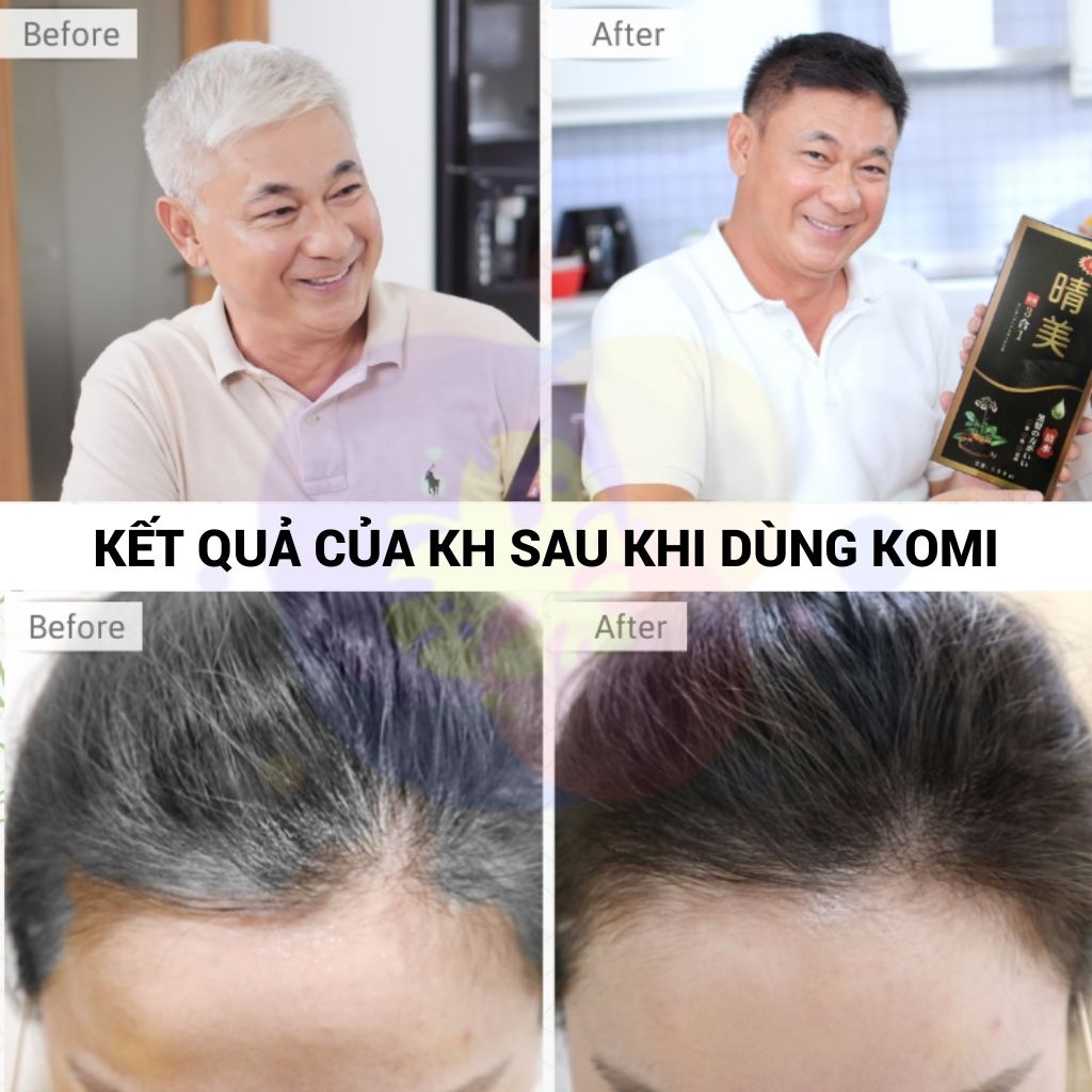 Dầu Gội Komi Nhật Bản Dầu Gội Phủ Bạc Nhật Bản Giúp Phủ Đen Tóc Không Dín Da Đầu Chai 500ml