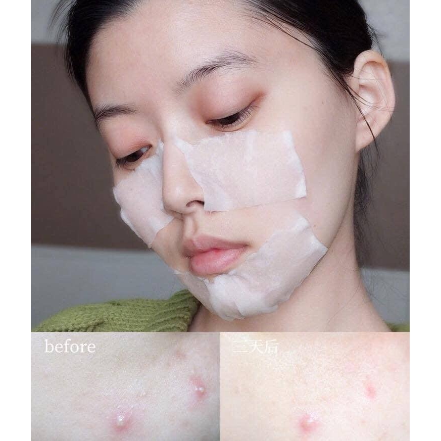 Nước hoa hồng hỗ trợ làm sạch mụn, điều tiết dầu nhờn some by mi aha bha pha 30 days miracle toner 150ml skin hub | BigBuy360 - bigbuy360.vn