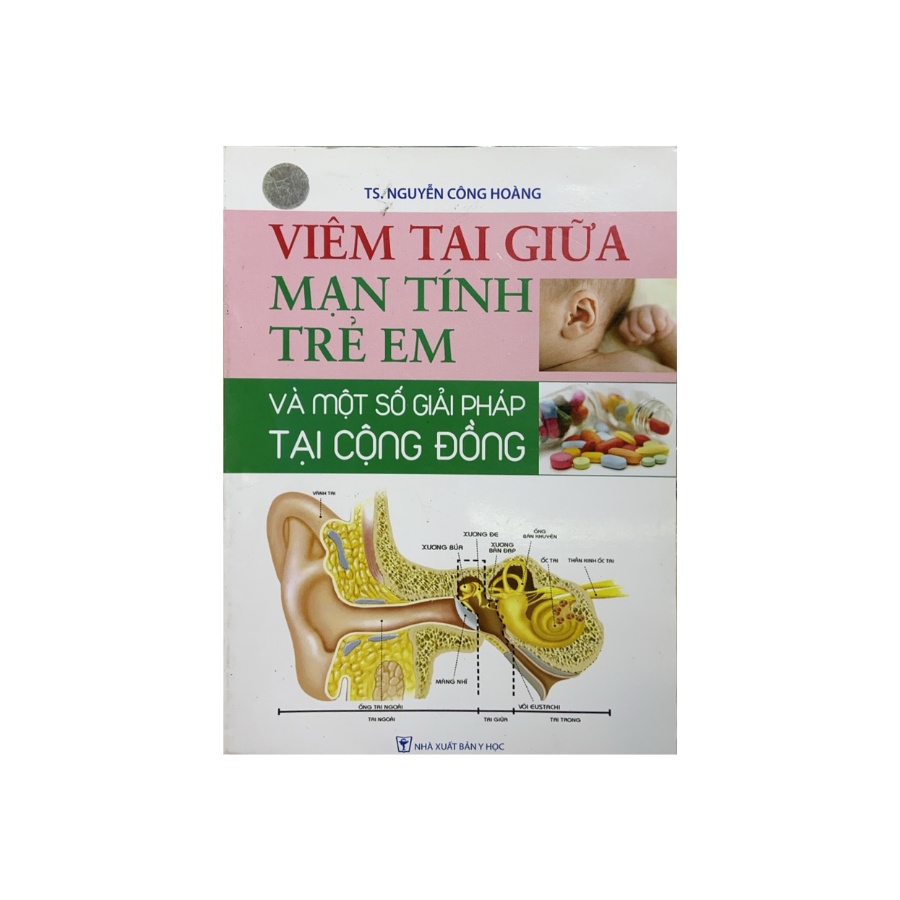 Sách - Viêm Tai Giữa Mạn Tính Trẻ Em Và Một Số Giải Pháp Tại Cộng Đồng