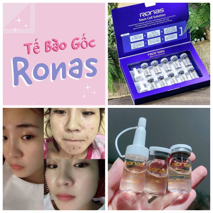 Tách lẻ 1 Lọ Kèm Nắp Bóp Tế Bào Gốc Ronas Hàn Quốc – Yu645