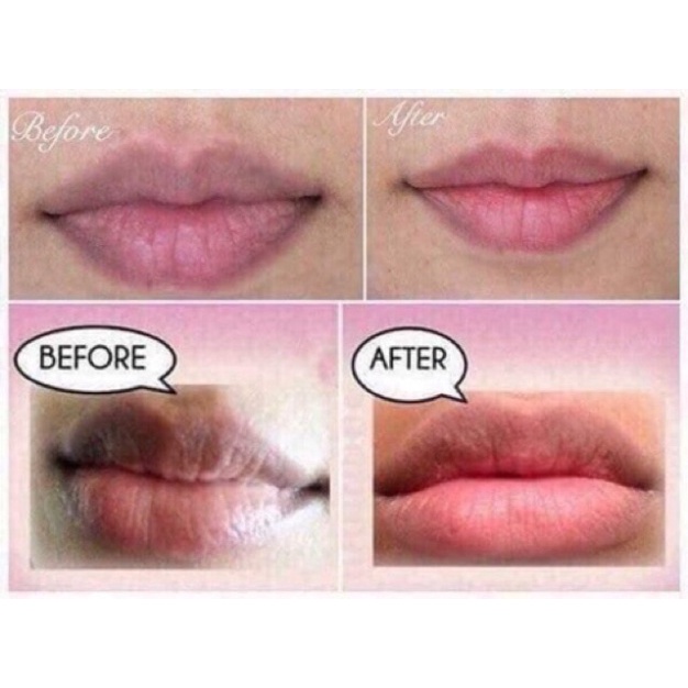 Dưỡng Môi Giảm Thâm Thái Lan