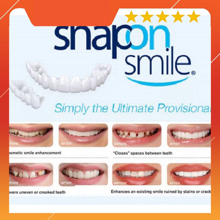 (Hàng Tốt) Răng giả Snap on smile - 4885 (Cao Cấp)