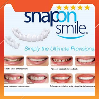 Răng giả snap on smile - 4885