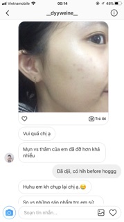 Kem dưỡng trắng da handmade