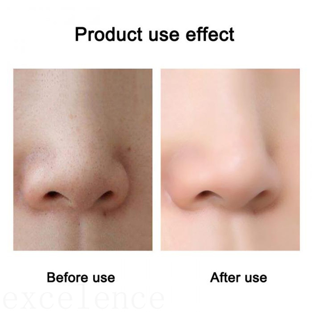 Tearing Mask Blackhead Acne Removing Skin Clean Peel Off Pores Shrink Face Cleansing Skin Care ELEN