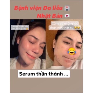 Serum Caramel Đường đen nhật bản ( phiên bản mới check cod )