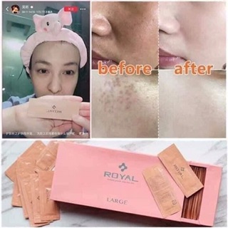 Serum nhau thai