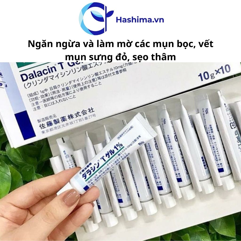 Kem mụn Da.la.cin T Gel 1% của Nhật Bản - Ngăn ngừa và làm mờ các loại mụn