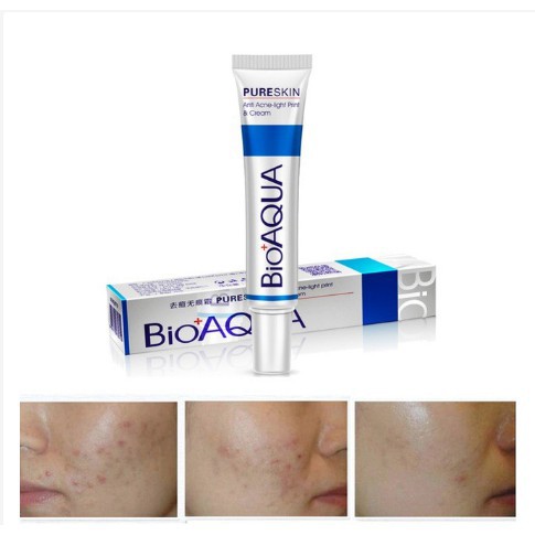 Kem BIOAQUA bôi dưỡng da ngăn mụn/ tái tạo tế bào hiệu quả 30g | BigBuy360 - bigbuy360.vn