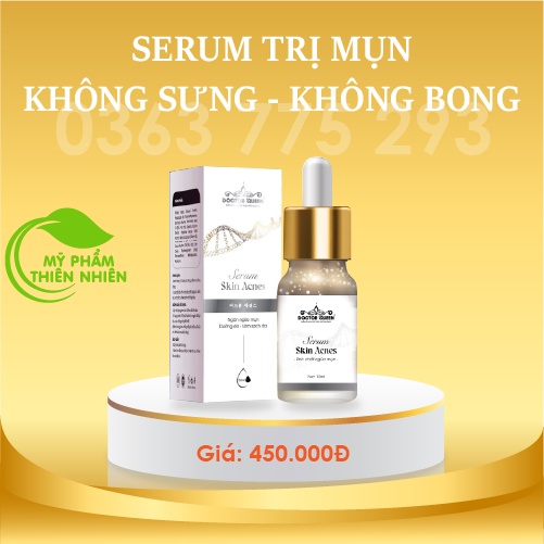 SERUM NGỪA MỤN-(MẪU MỚI)- (mụn ko bong,K sưng,k đỏ)