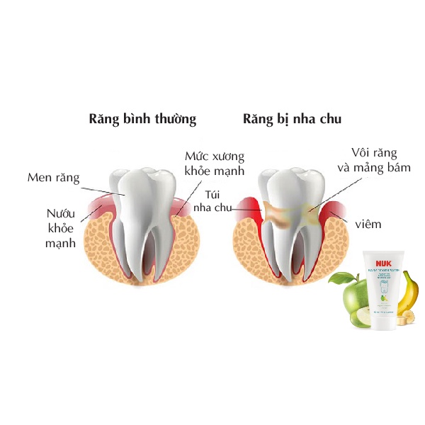 Kem đánh răng trẻ em không Flouride NUK cho bé 3-36 tháng