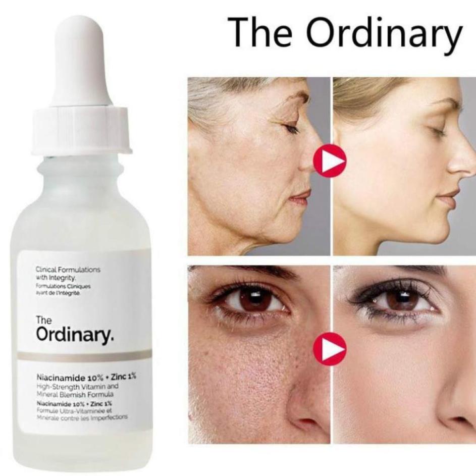 Tinh Chất Dưỡng Da The Ordinary Niacinamide 10%+Zinc 1% 30ml Dưỡng Ẩm Trắng Da,Tinh Chất Dưỡng Ordinary Cho Da Dầu Mụn | BigBuy360 - bigbuy360.vn