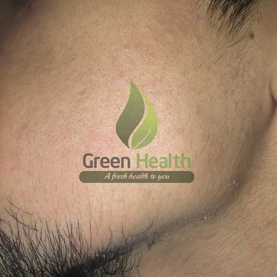 Thuốc mọc râu tóc Minoxidil 5% member's mask