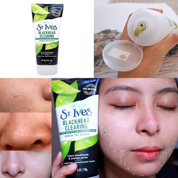 Sữa Rửa Mặt Tẩy Tế Bào Chết St.Ives