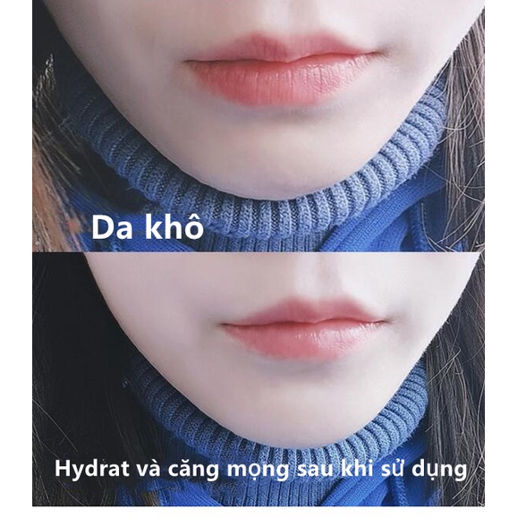 Mặt nạ môi khi ngủ RNW giúp dưỡng ẩm và tẩy tế bào chết