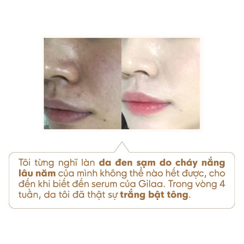 Tinh chất dưỡng trắng Gilaa Saffron Tone up Repair Serum - 20ml | BigBuy360 - bigbuy360.vn