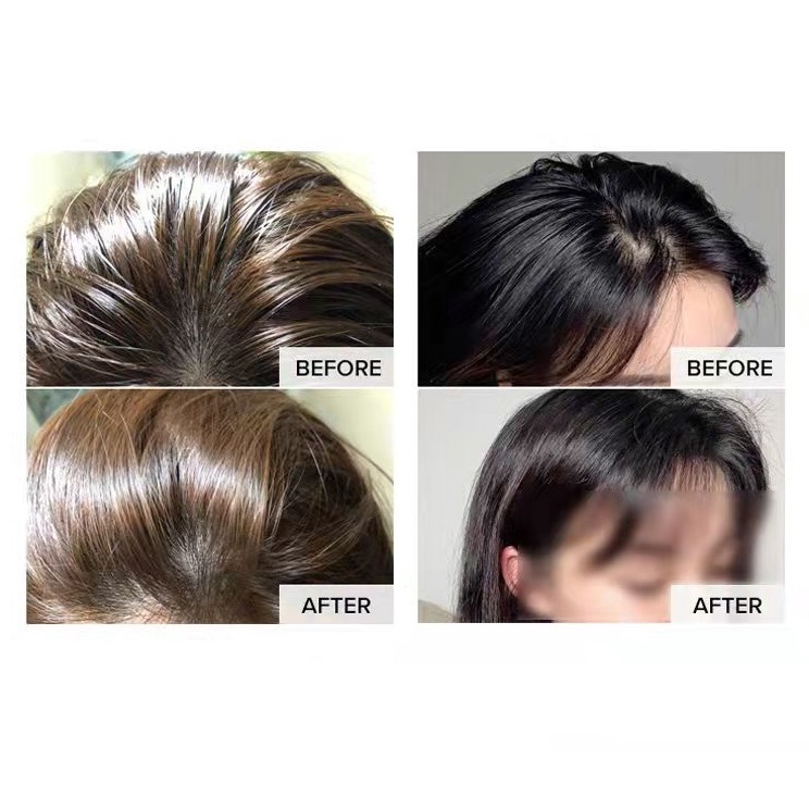 Xịt gội đầu khô cấp tốc nội địa trung giúp tóc bồng bềnh suốt 8h không dầu, không bết dính