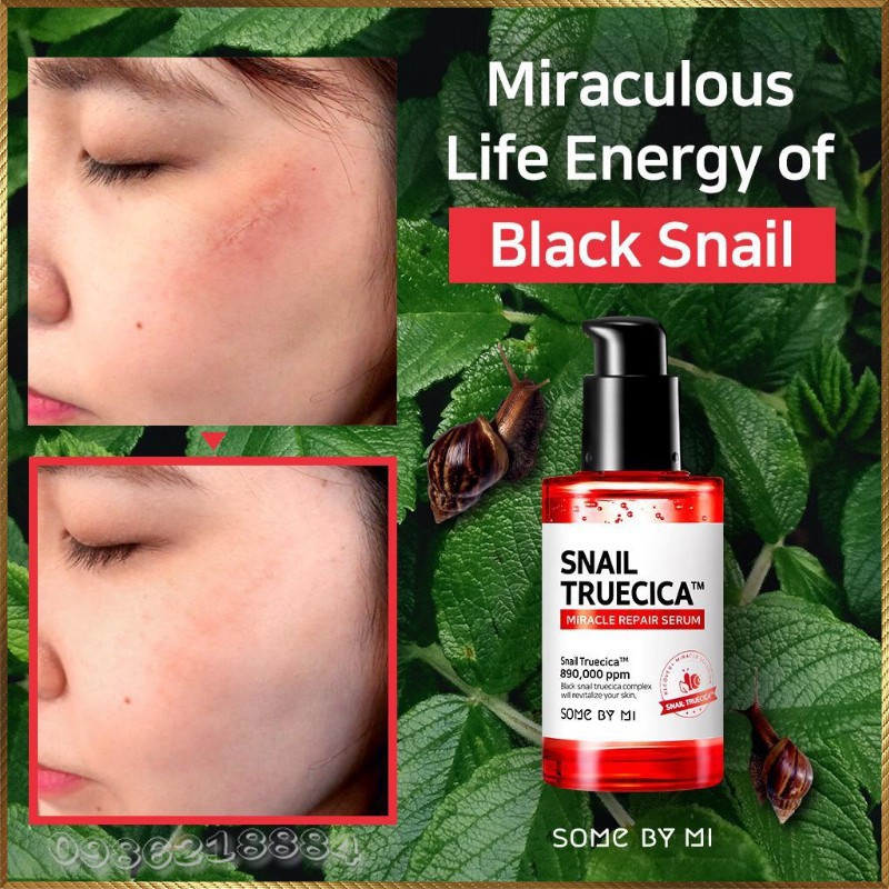 [FSS] Tinh chất ốc sên đen cho da Sẹo Some By Mi Snail Truecica Miracle | BigBuy360 - bigbuy360.vn