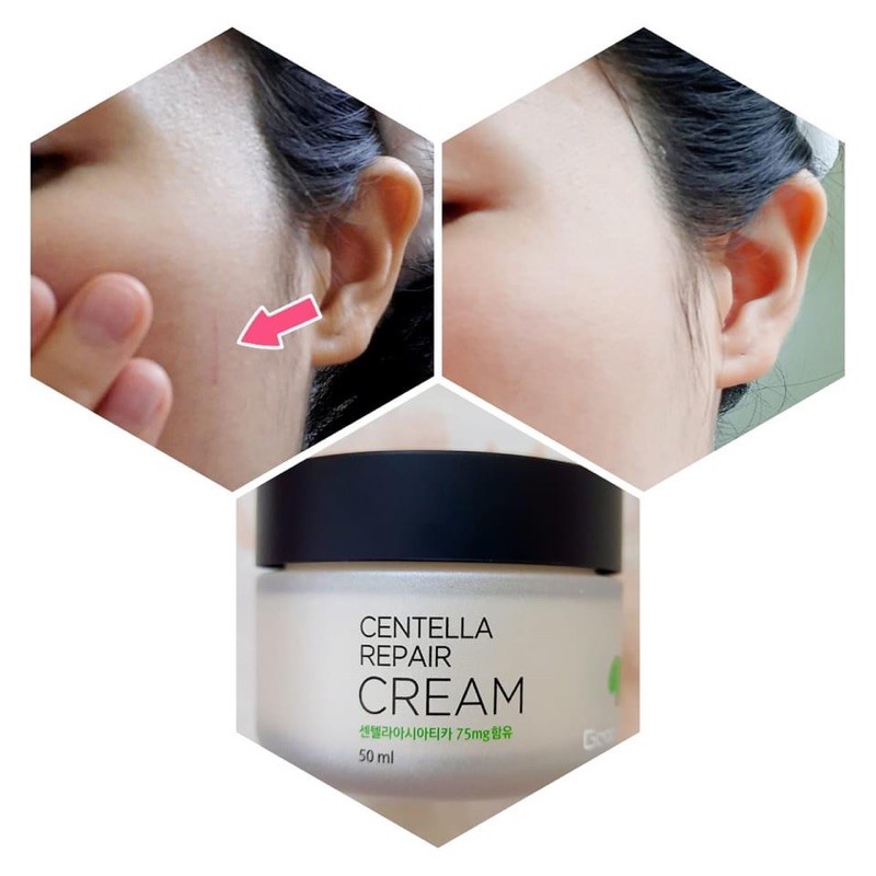 Kem Rau Má GoodnDoc Centella Repair Cream Dưỡng Ẩm_Phục Hồi Da (Hộp 50ml)