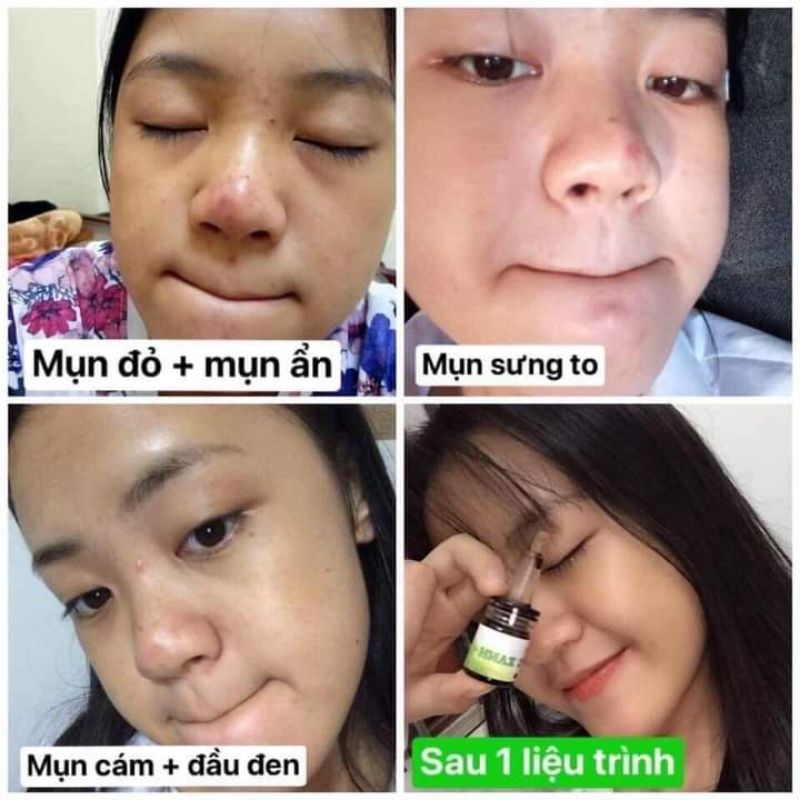 Serum thảo mộc xanh