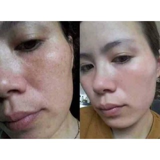 Kem đỏ thái lan