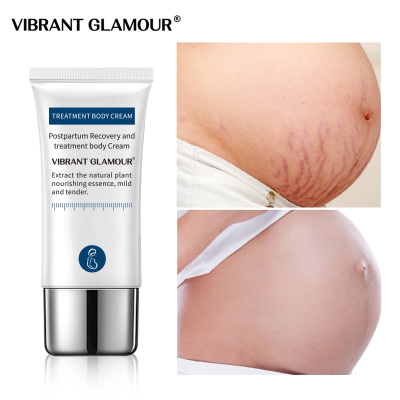 Kem Hỗ Trợ Giảm Sẹo Sau Khi Sinh VIBRANT GLAMOUR Làm Trắng Và Săn Chắc Mịn Mượt Chống Lão Hóa 30g