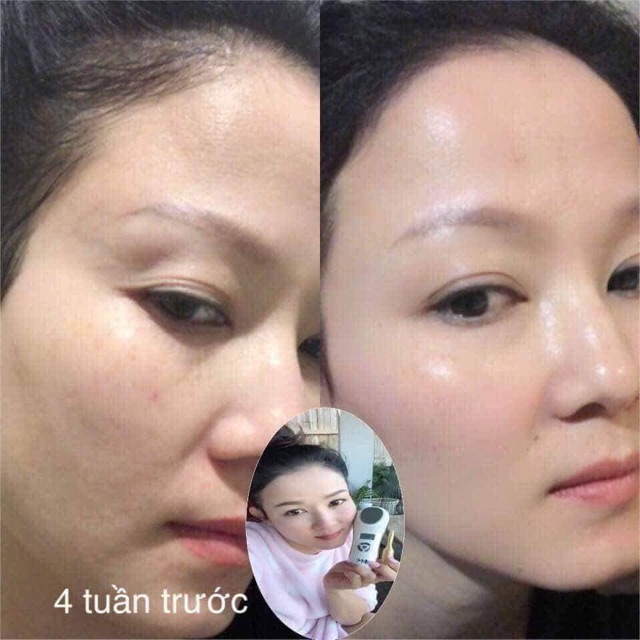 Siêu tinh chất thảo mộc Keo Ong Ampoule tặng máy đẩy tinh chất