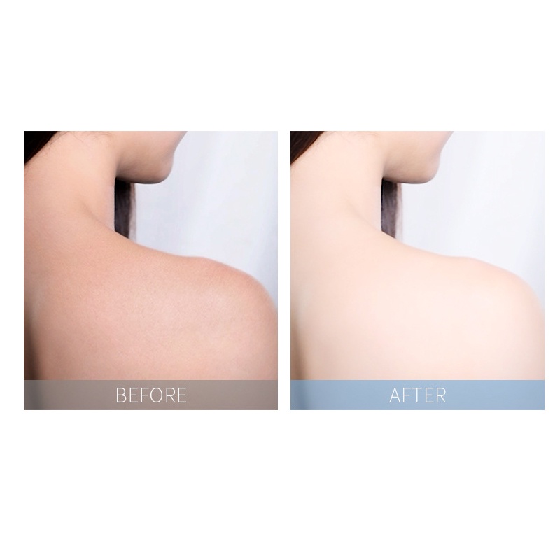 Kem Tẩy Tế Bào Chết Fenyi Làm Sạch Sâu Cho Cơ Thể