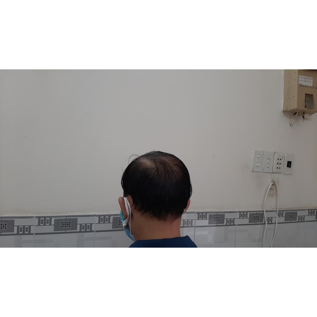 Tóc Giả Ngắn Dành Cho Nam - Chất lượng số 1