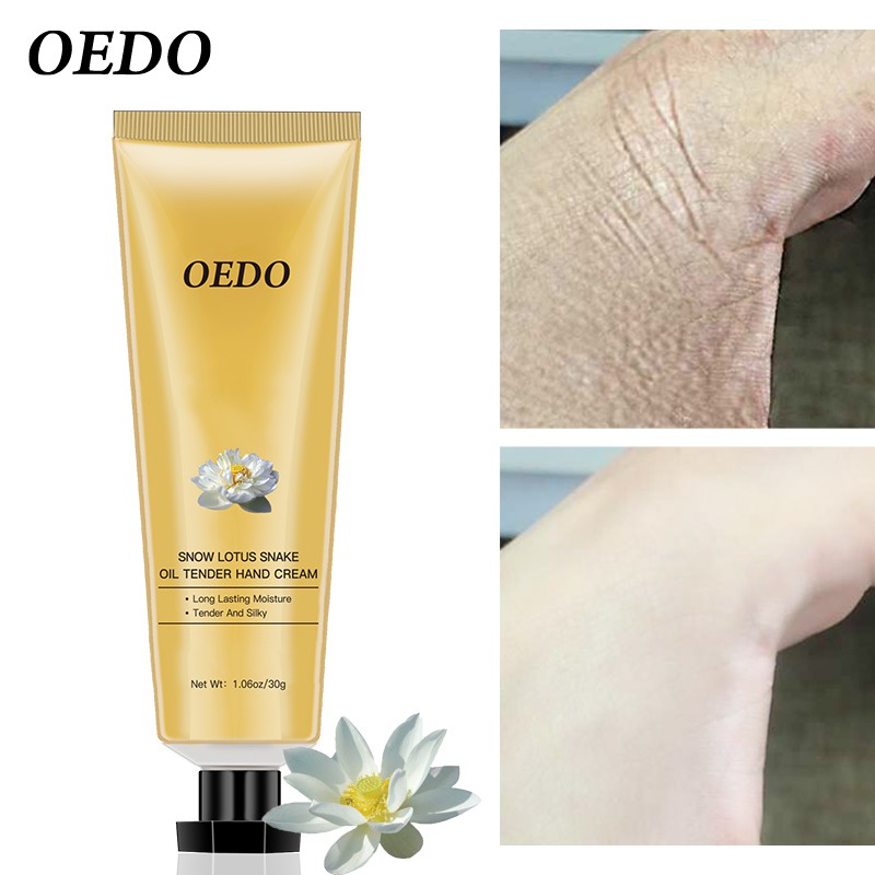 Kem dưỡng da tay OEDO chiết xuất từ dầu cá và hoa sen kháng khuẩn chống nhăn | BigBuy360 - bigbuy360.vn