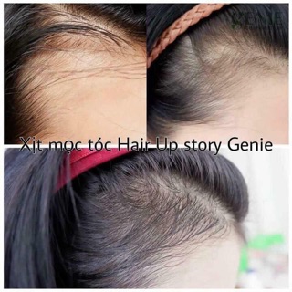 Xịt Kích Mọc Tóc Genie