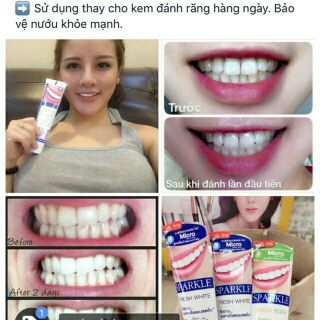KEM ĐÁNH RĂNG SIÊU TRẮNG SPARKLE FRESH WHITE