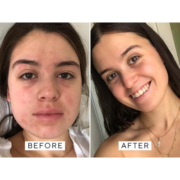 Serum Cấp Ẩm Tái Tạo Da Săn Chắc La Roche Posay Hyalu B5 Serum 30ML