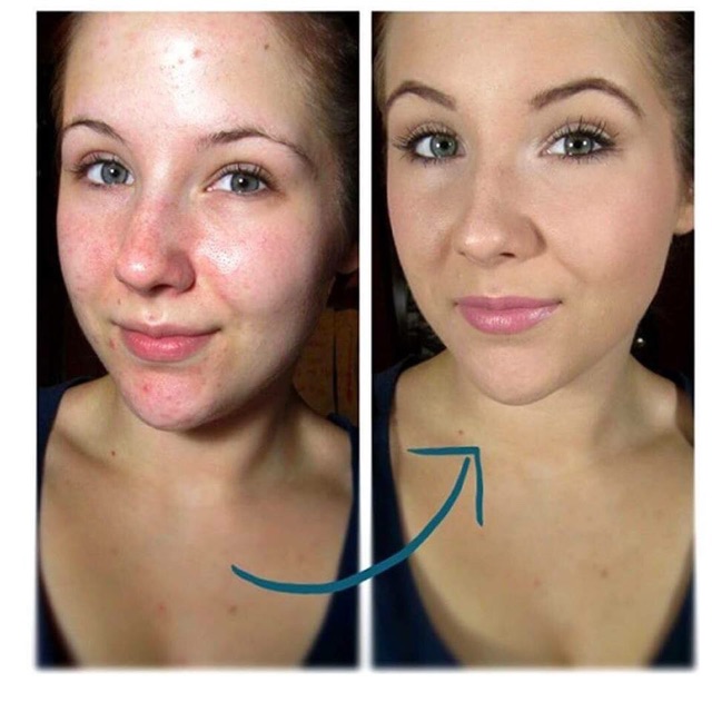 Kem Nền Revlon Colorstay 24h | BigBuy360 - bigbuy360.vn