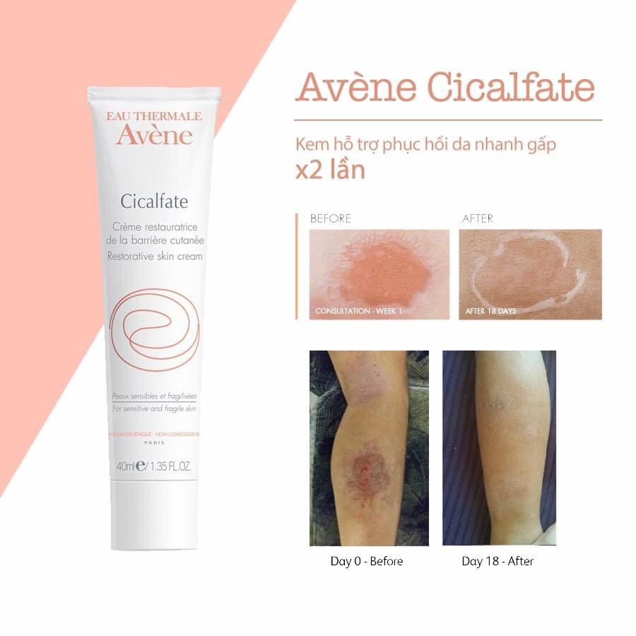 Kem làm lành da liền sẹo Avene cicalfate+ repairing protective cream 40ml- 100ml