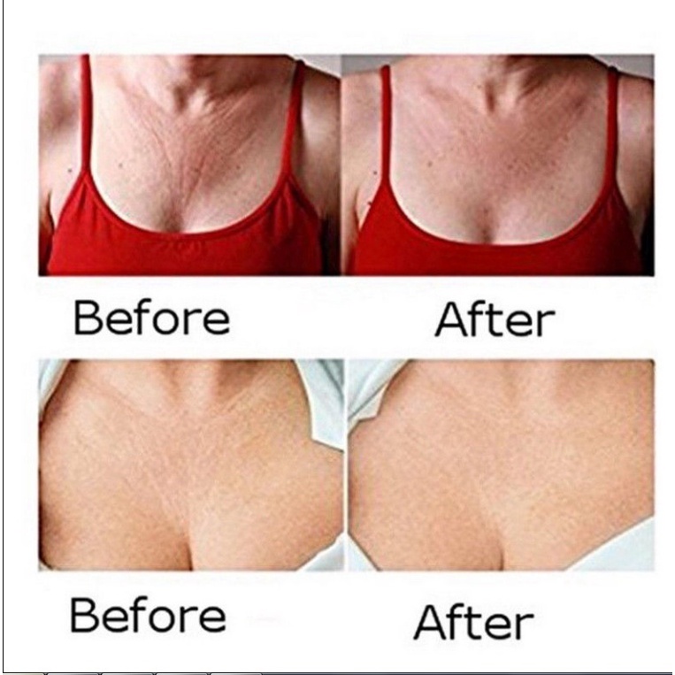 [Hàng mới về] Kem dưỡng da mặt và cổ ngăn ngừa nếp nhăn săn chắc da | BigBuy360 - bigbuy360.vn