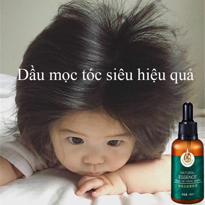 Tinh chất mọc tóc tinh dầu mọc tóc 30ml serum kích mọc tóc chăm sóc tóc chống rụng tóc,kích thích tóc mọc dà