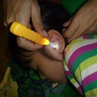DỤNG CỤ LẤY RÁY TAI CÓ ĐÈN