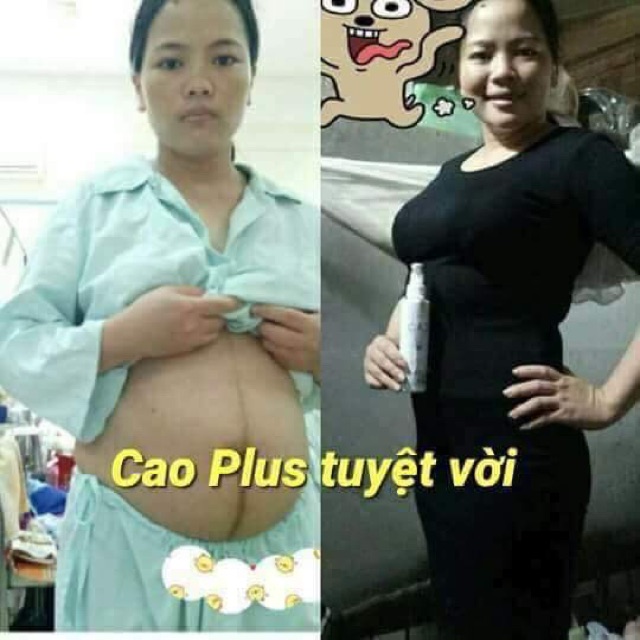 Bộ caoo lá rừng plus  , giúp bạn có vòng eo thon gọn, chấp các các ngấn mỡ, dù lâu năm hay là mới thì bạn sẽ thấy