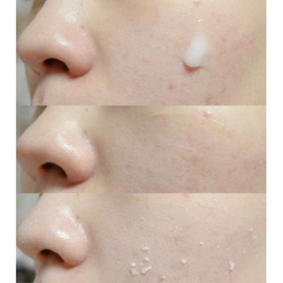 Tẩy tế bào chết Misha Aqua