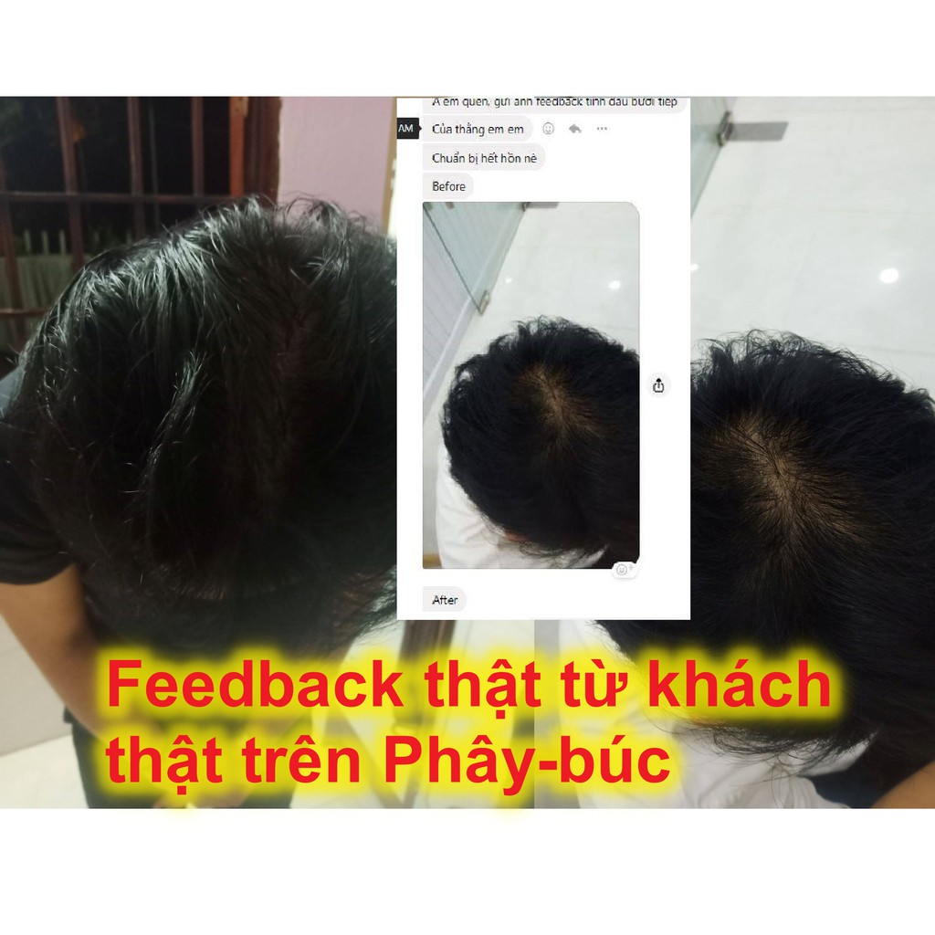 Xịt bưởi kích mọc tóc nhanh, ngăn rụng tóc sau sinh, thơm tóc, dưỡng mượt phục hồi tóc AloAroma Hair Lotion 100ml