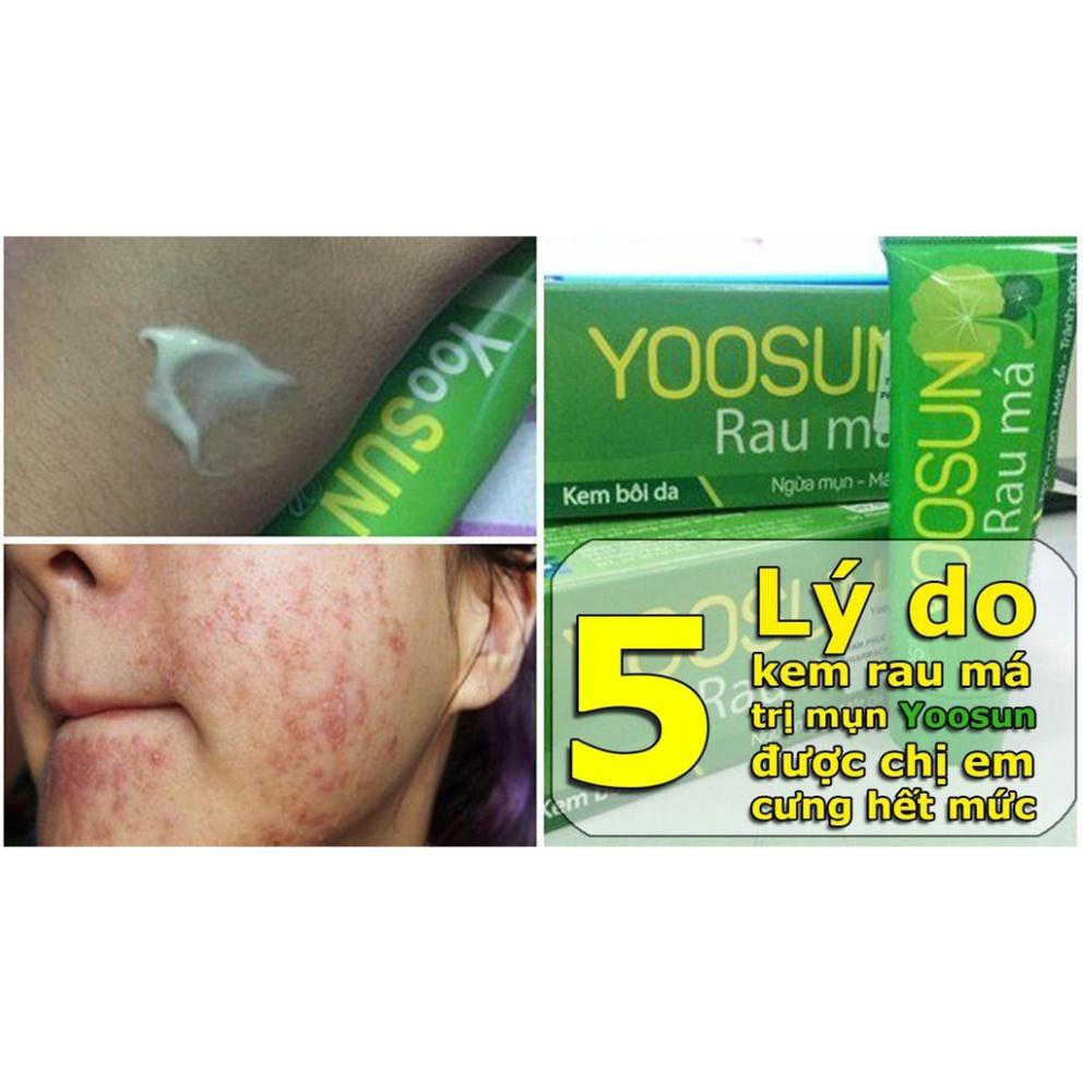 Kem YooSun Rau má / tinh chất nghệ - ngăn ngừa mụn - mát da - lành sẹo Yoosun nghệ