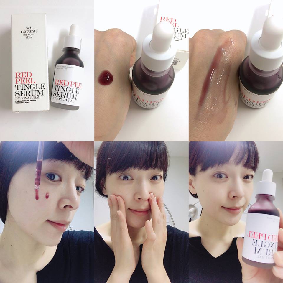 Tinh chất Red Peel Tinglee Serum